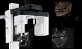 被曝量を抑えた高精細な歯科用CT